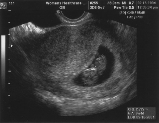 02.16.2004 9 weeks