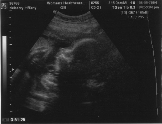 06.09.2004 26 weeks