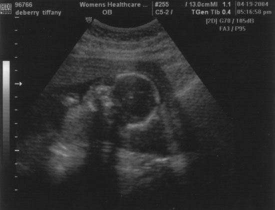 04.19.2004