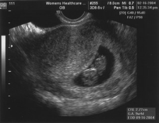 02.16.2004 9 weeks