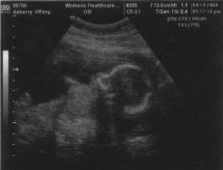 04.19.2004 18 weeks